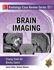 Picture of Brain Imaging