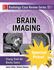Picture of Brain Imaging Case Review