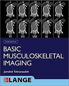 Picture of Basic Musculoskeletal Imaging 2nd Ed. CE Course