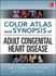 Picture of Adult Congenital Heart Disease
