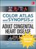 Picture of Adult Congenital Heart Disease